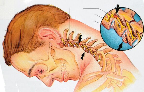 De structuur van de cervicale wervels